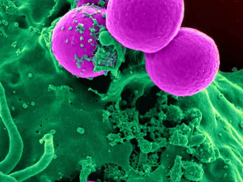 You Thought Your Diet Was Bad? Wait Until You Read About These&nbsp;Bacteria.