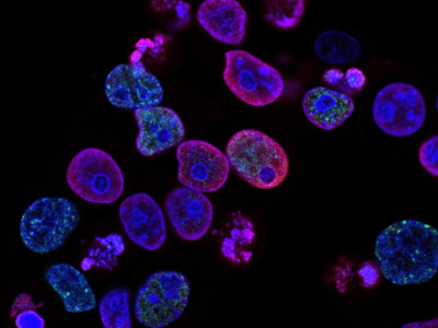 Help with Hormones: How Joining Sports Can Make You&nbsp;Happier